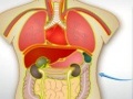 Transplant de organe 2 pentru a juca on-line